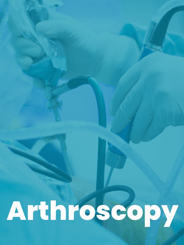 Arthroscopy Treatment In Surat Image
