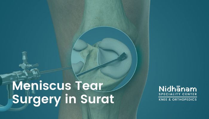Meniscus tear surgery in Surat - Nidhanam